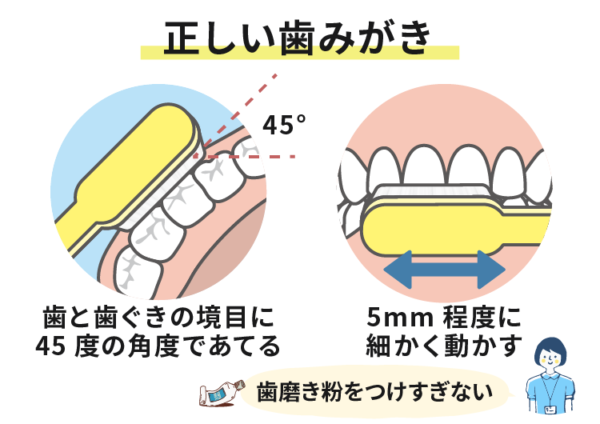 適切な歯みがき　正しい歯みがき