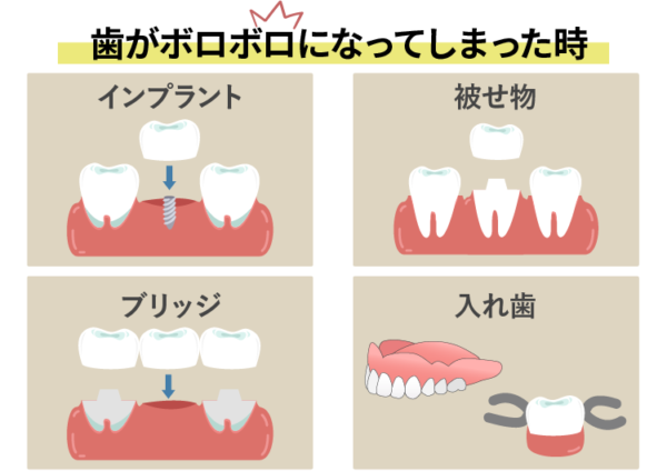 ボロボロになった歯の治療方法