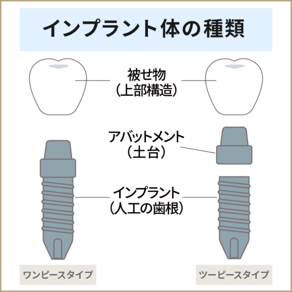 インプラントの種類