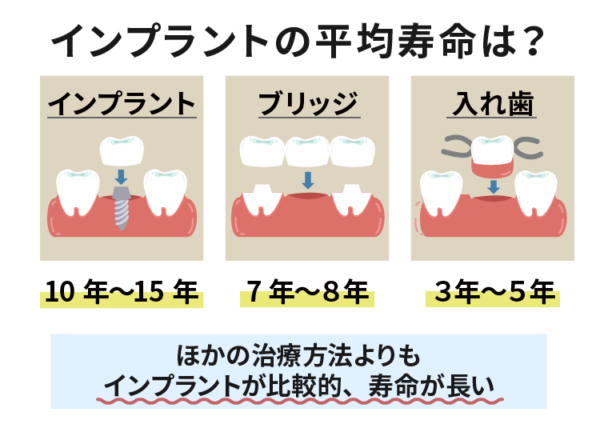 インプラントの平均寿命