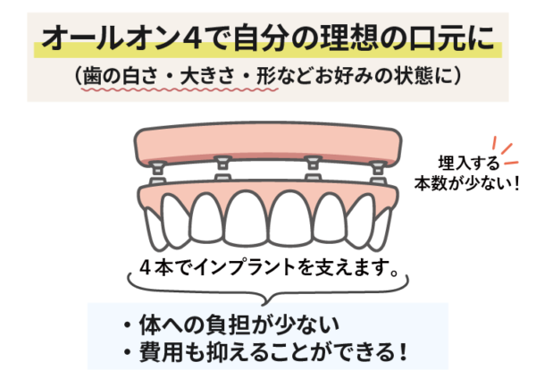 オールオン4で自分の理想の口元に